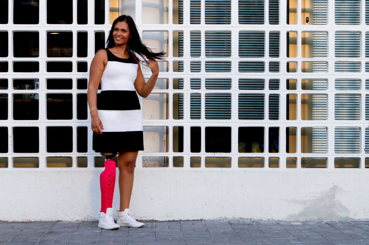 Vítima de amputação usando a capa para prótese "Confete", projeto da Furf. Foto: Divulgação